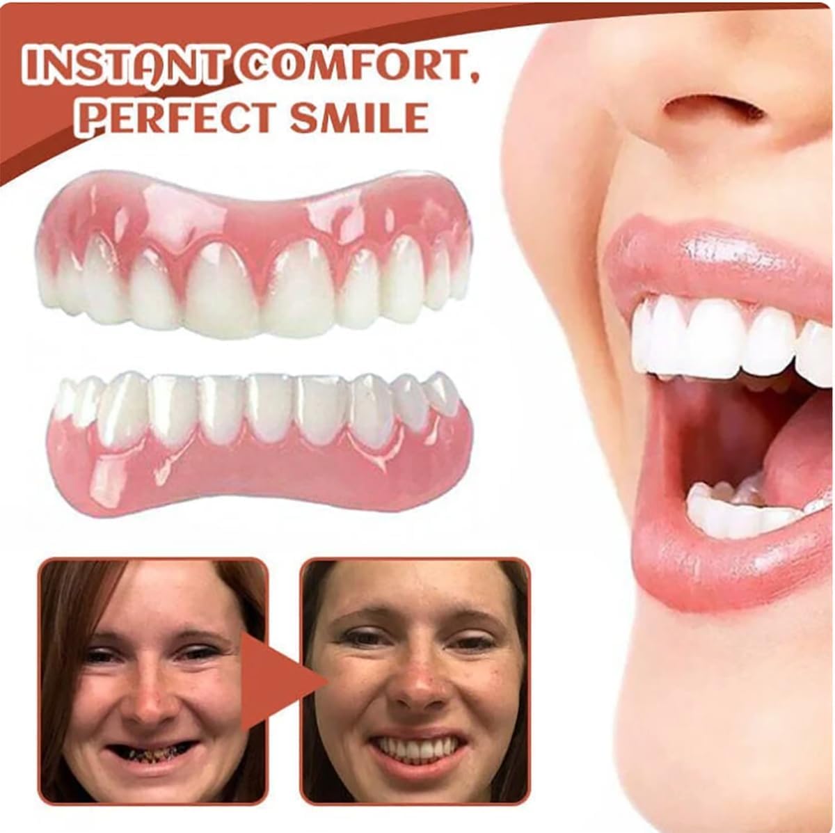 Silicone Denture Reline Kit 2 Set R6783